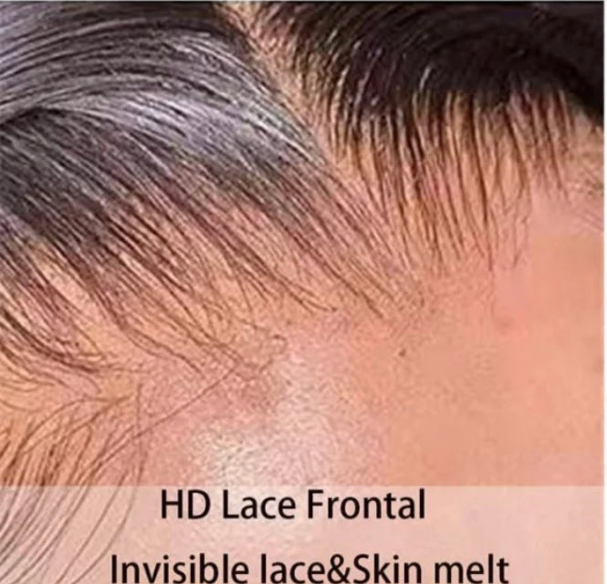 HD Frontal